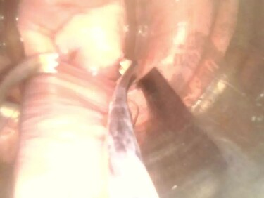 無修正FC2 PPV 4867433 -B ももかちゃん危険日子宮拡張　本気の妊活＃７