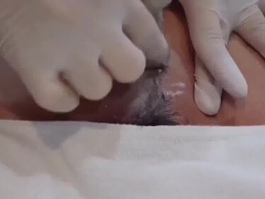 Thumb 1