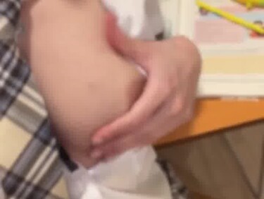 Thumb 1